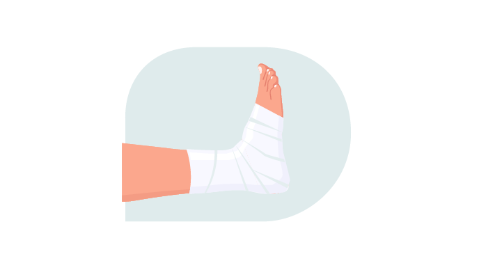 ACT Zwachtelen | Compressietherapie