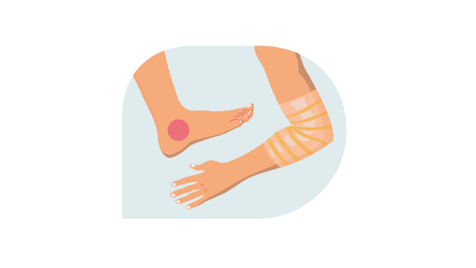 PAV & Enkel/Teen Arm Index