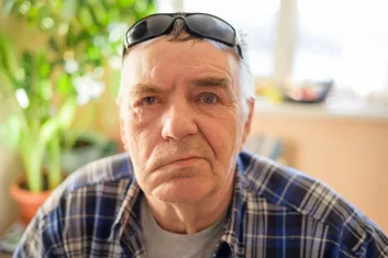 Aged man with facial nerve paralysis, Bell's palsy.